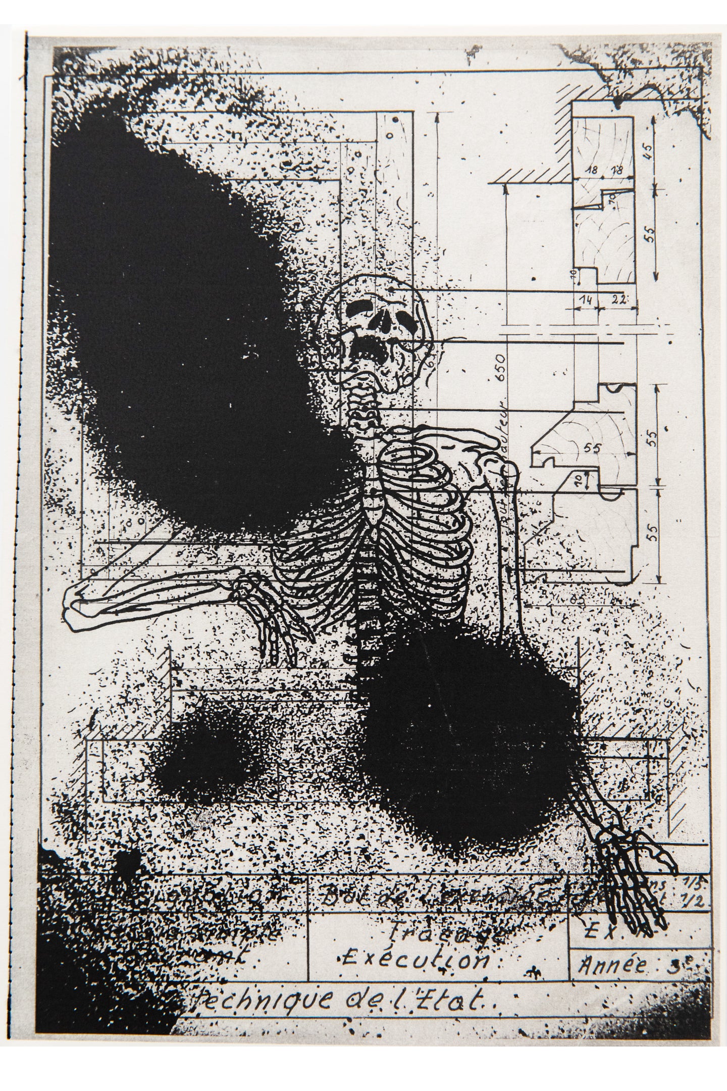 MON PÈRE EST MORT DE ÉLANCOLIE