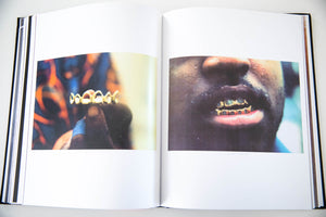 MOUTH FULL OF GOLDS