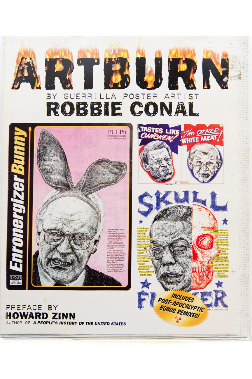 ARTBURN
