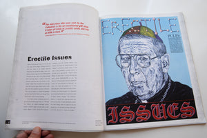 ARTBURN